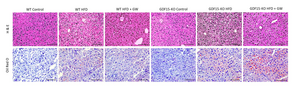 CDF15 cytokine