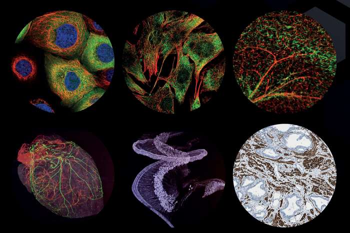 Images from the Human Protein Atlas