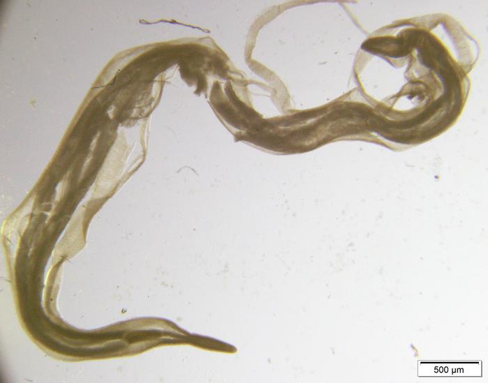 Anisakid worm [IMAGE] | EurekAlert! Science News Releases