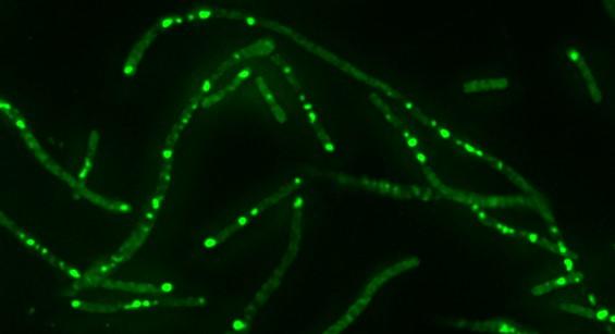 Antibiotic-induced DNA Breaks in <em>E. coli</em>