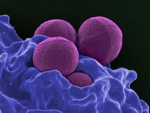 MRSA micrograph