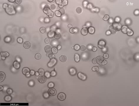 Time-lapse of HSV-1 infection in ectocervical organoids