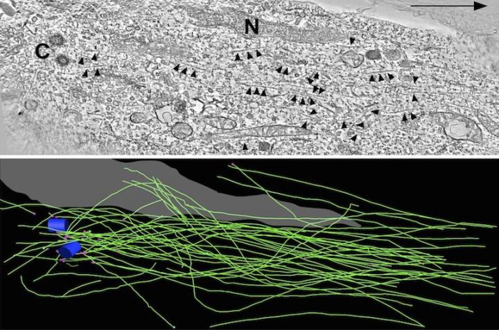 Analysis of Microtubule Organization in a Neuron