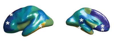 Altered Asymmetry of Cerebral Cortex Thickness in Autism Spectrum Disorder