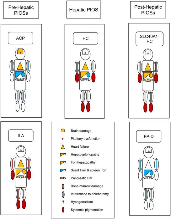 A Revised Classification of Primary Iron Overload Syndromes