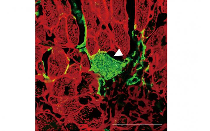 How the body regulates scar tissue growth after heart attacks