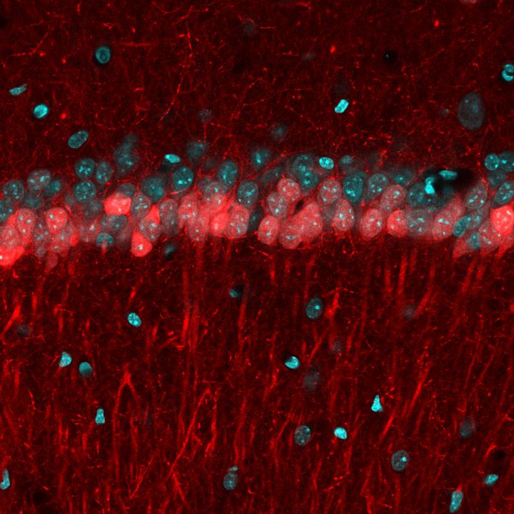 Two Sublayers of Area CA1 in an Awake Mouse