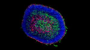 Retinal organoid derived from porcine pluripotent stem cells