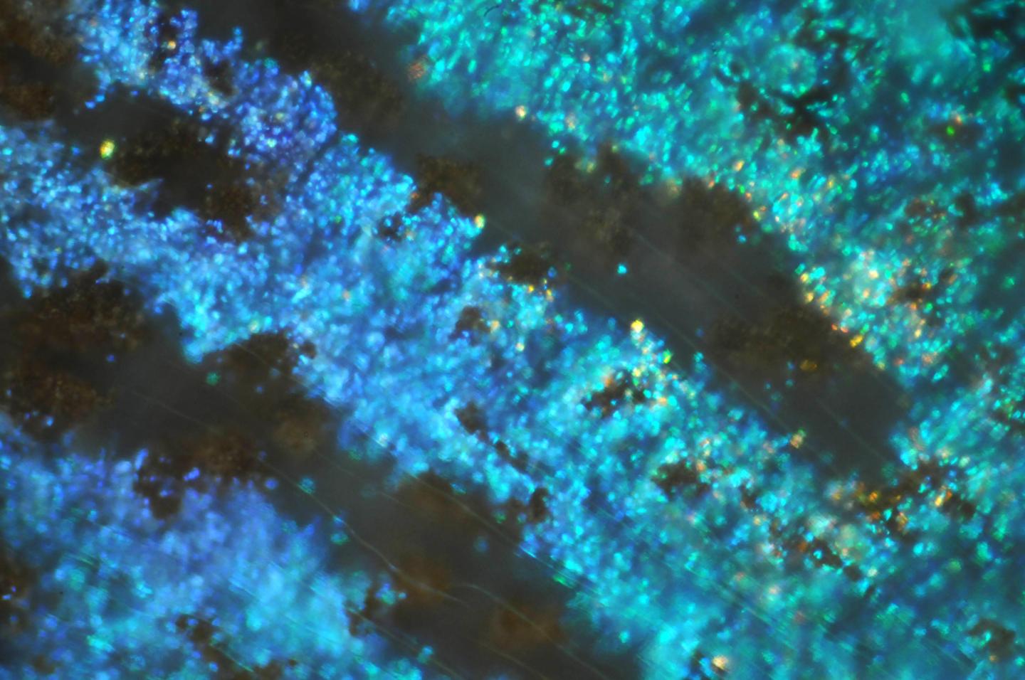 Iridocytes in Detail