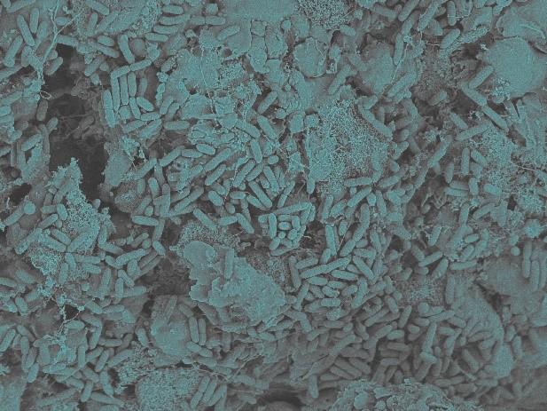 Whether a Urinary Tract Infection Recurs May Depend on the Bacterial Strain