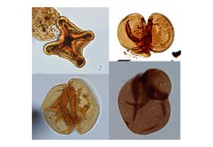 Examples of severely malformed and teratologic spores from Schandelah-1, and other locations