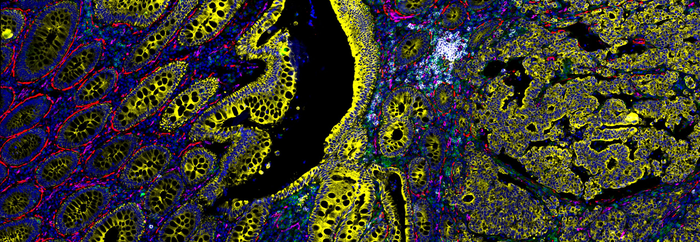 Multiplexed image of the colon