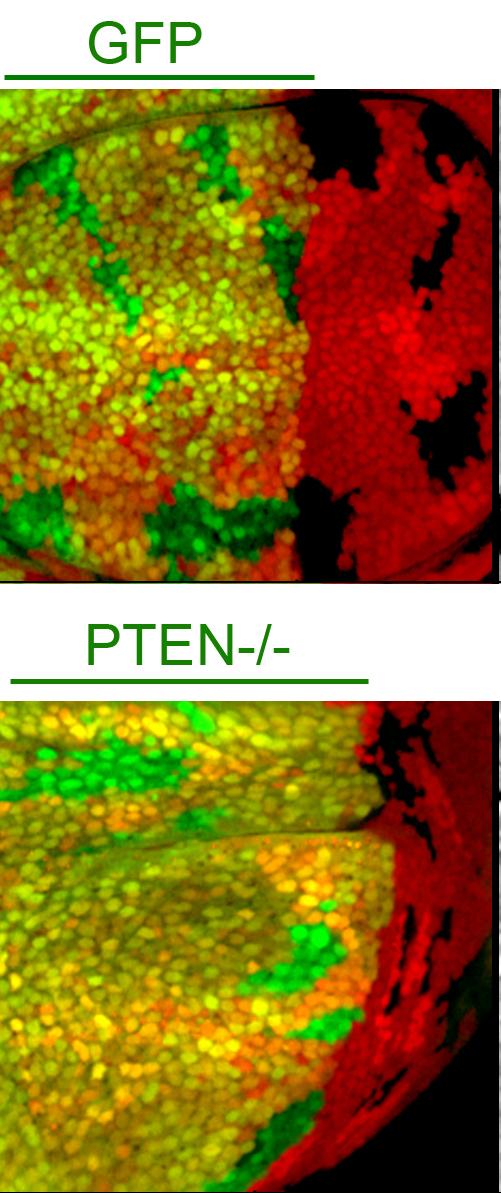 PTEN Tumor Suppressor