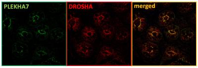 Localization of PLEKHA7 and the RNAi Machinery