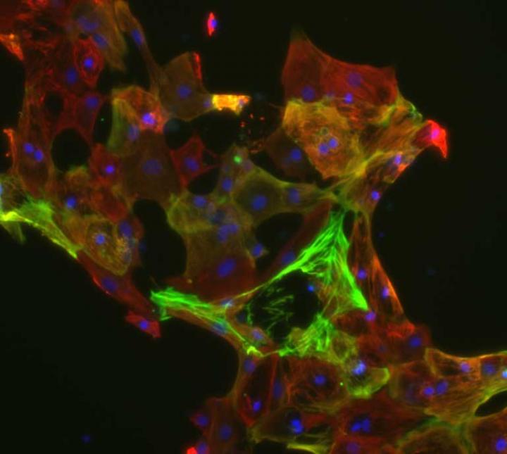 Cardiomyocytes Post-Mitochondrial Replacement Therapy 2