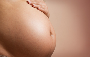 Birth choices after previous cesarean and risk of pelvic floor surgery