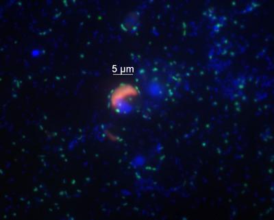 <I>In situ</I> Hybridization