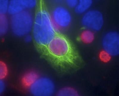 Chlamydial Infection