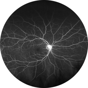 Image of a retina