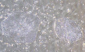 Induced Pluripotent Stem Cells