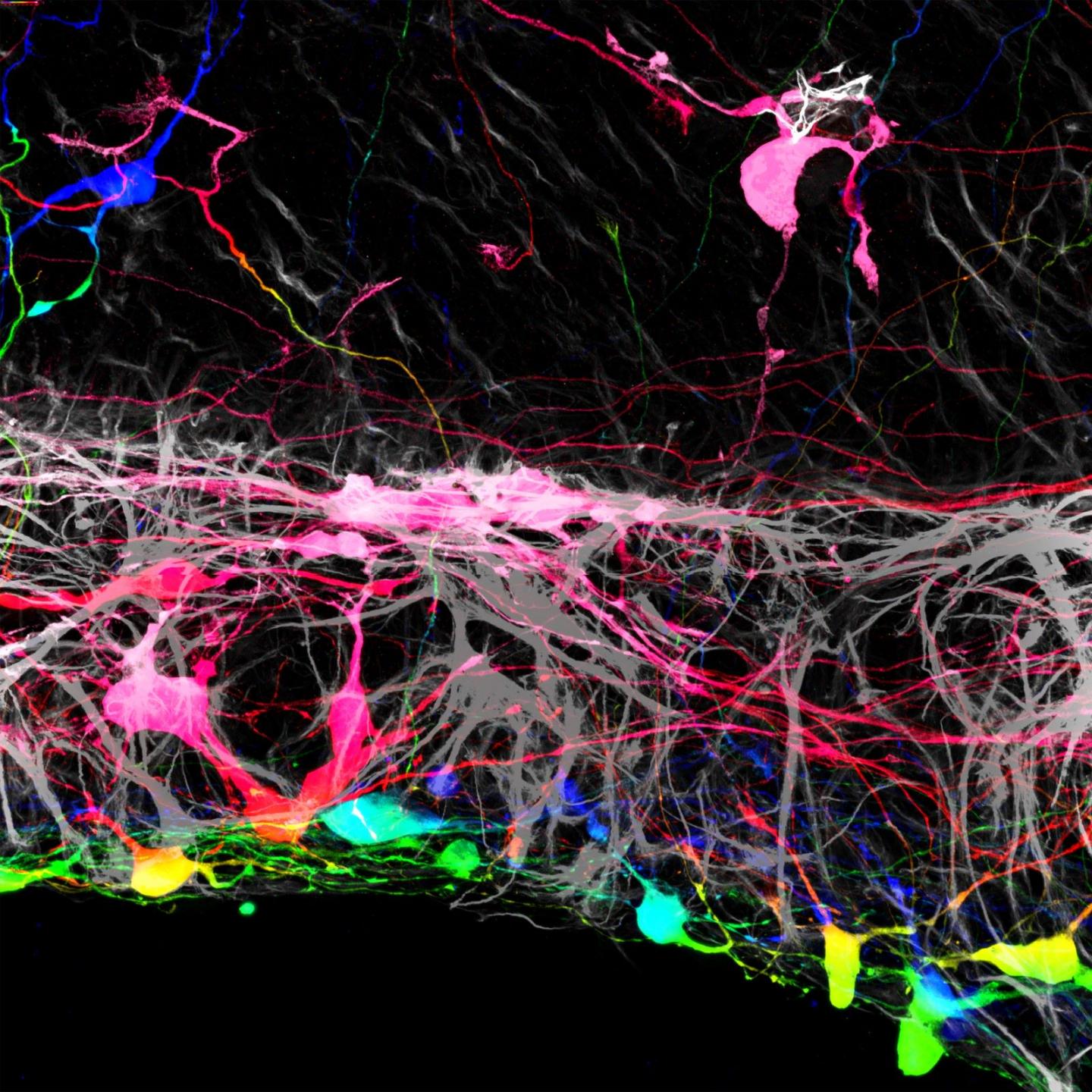 Transplanted retinal ganglion