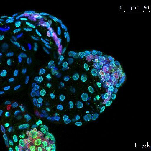 Mouse Blastocyst in 'Diapause,' a Natural State of Arrested Development