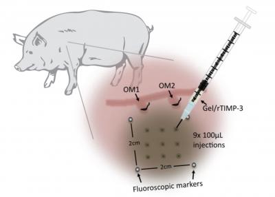 Injectable Hydrogel Halts Heart Failure (1 of 2)