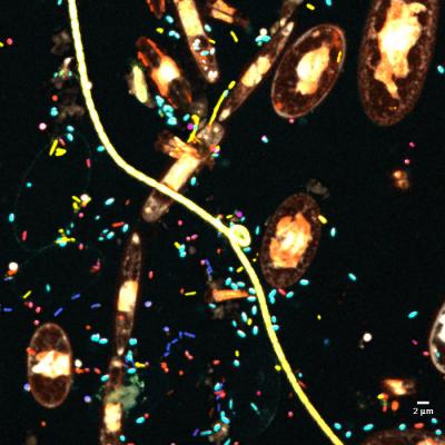 Microbial Communities Colonizing Microplastics Collected from North Atlantic Ocean (Woods Hole, Mass