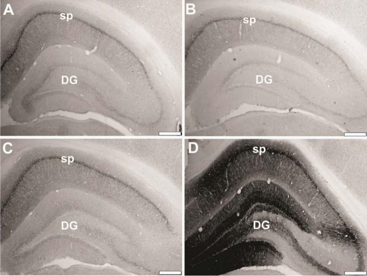 Hippocampal FKBP1b