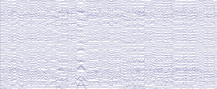 Brain activity recorded by the EEG cap
