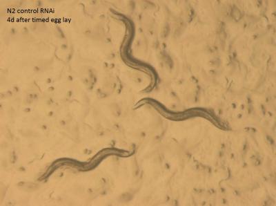 Normal Young Adult <i>C. elegans</i> with Eggs and Freshly Hatched Babies