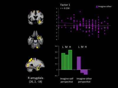 Response in the Right Amygdala