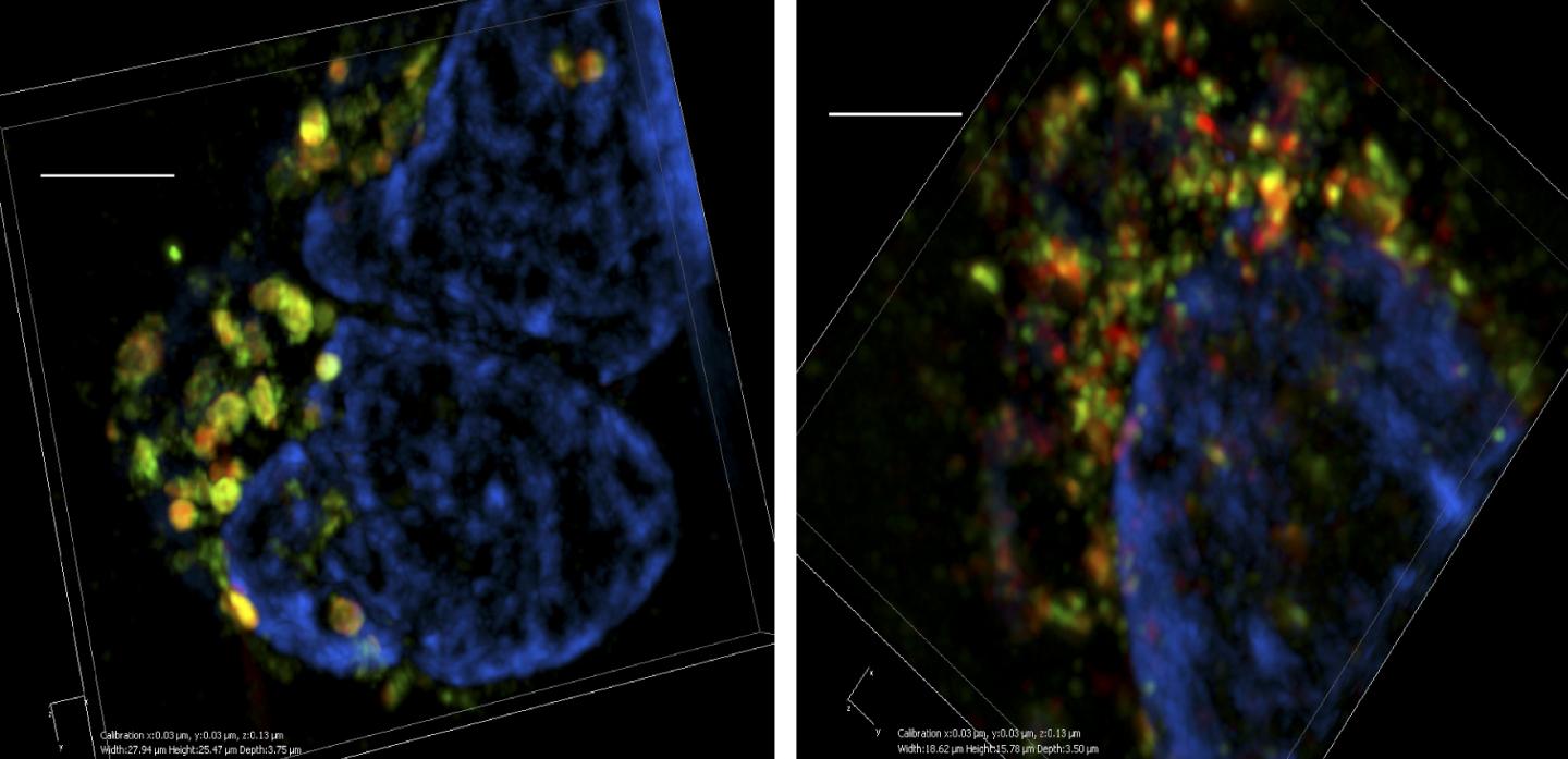 Munc13-4 Promotes Exosome Release from Cancer Cells