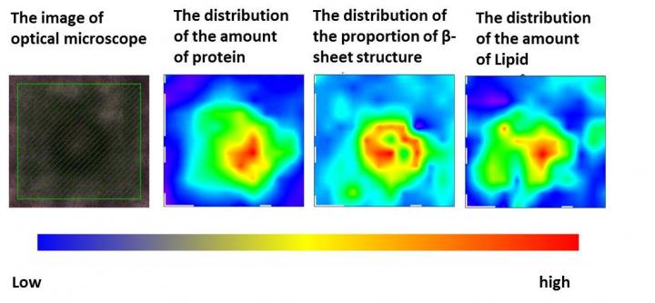 Analysis Results for Typical Lewy Bodies (Fig. 1)