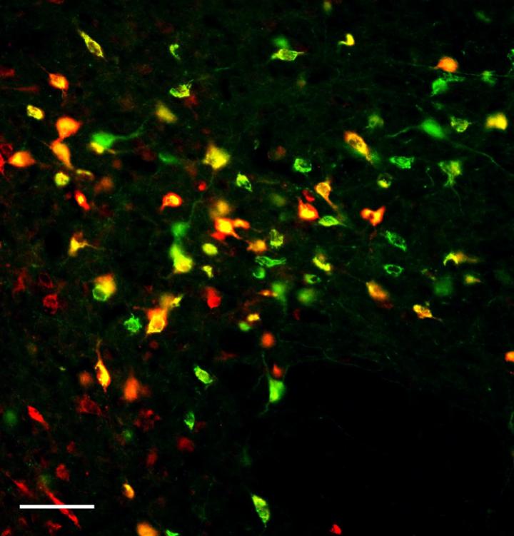 Hunger Peptides Connecting with Cells Via  Brain Fluid