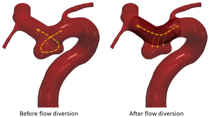 Effect of a Blood Diverter