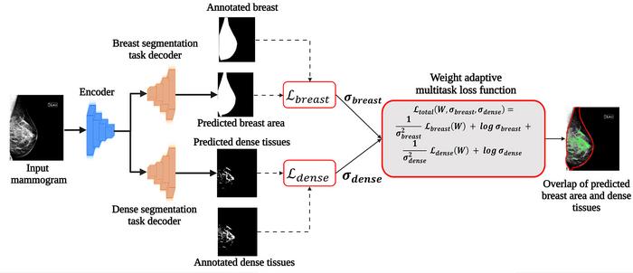 An advanced architecture for accurate mammogram segmentation.