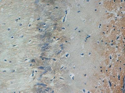 Beclin-1 Protein Expression