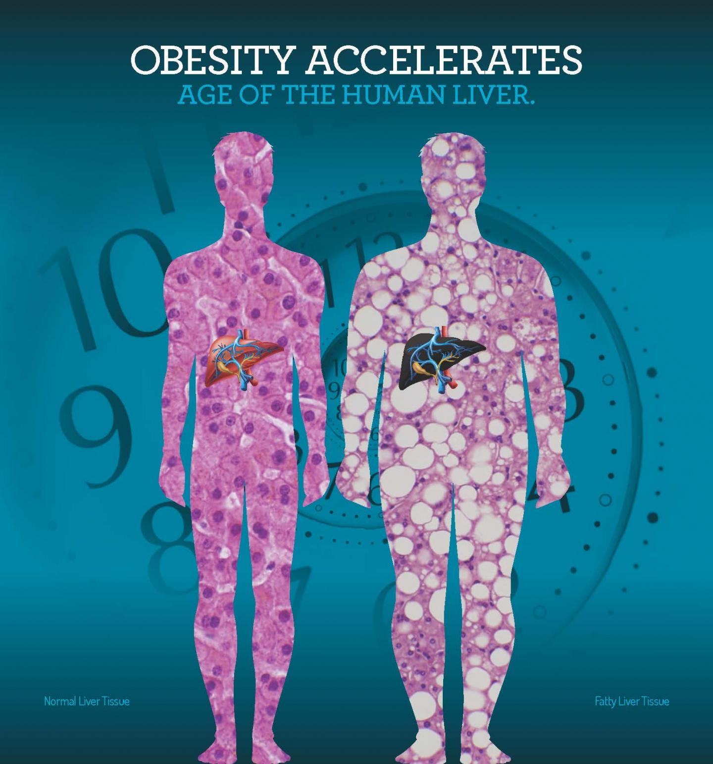 Obesity Ages Liver