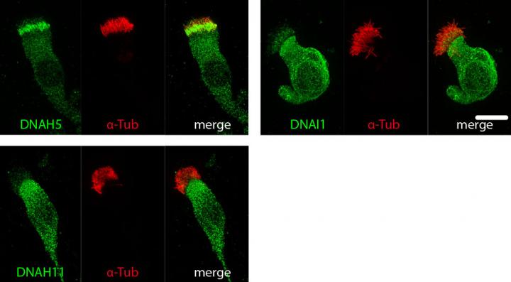 High-Resolution Imaging Toolbox Scopes Out Genetic Lung Disorder Using Hairy Cells (2 of 3)