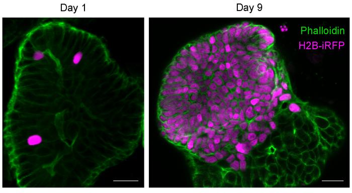 The representative images of tuft cell progenity, H2B-iRFP+cells, following irradiation in tuft cell lineage tracing organoids.