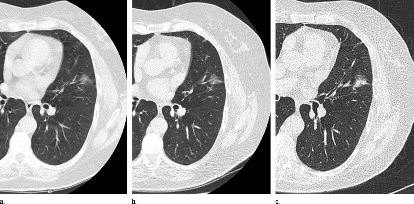 ct-images-image-eurekalert-science-news-releases