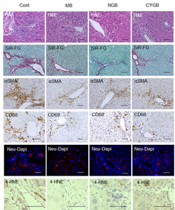 MB, NGB, and CYGB blocked liver fibrosis in vivo