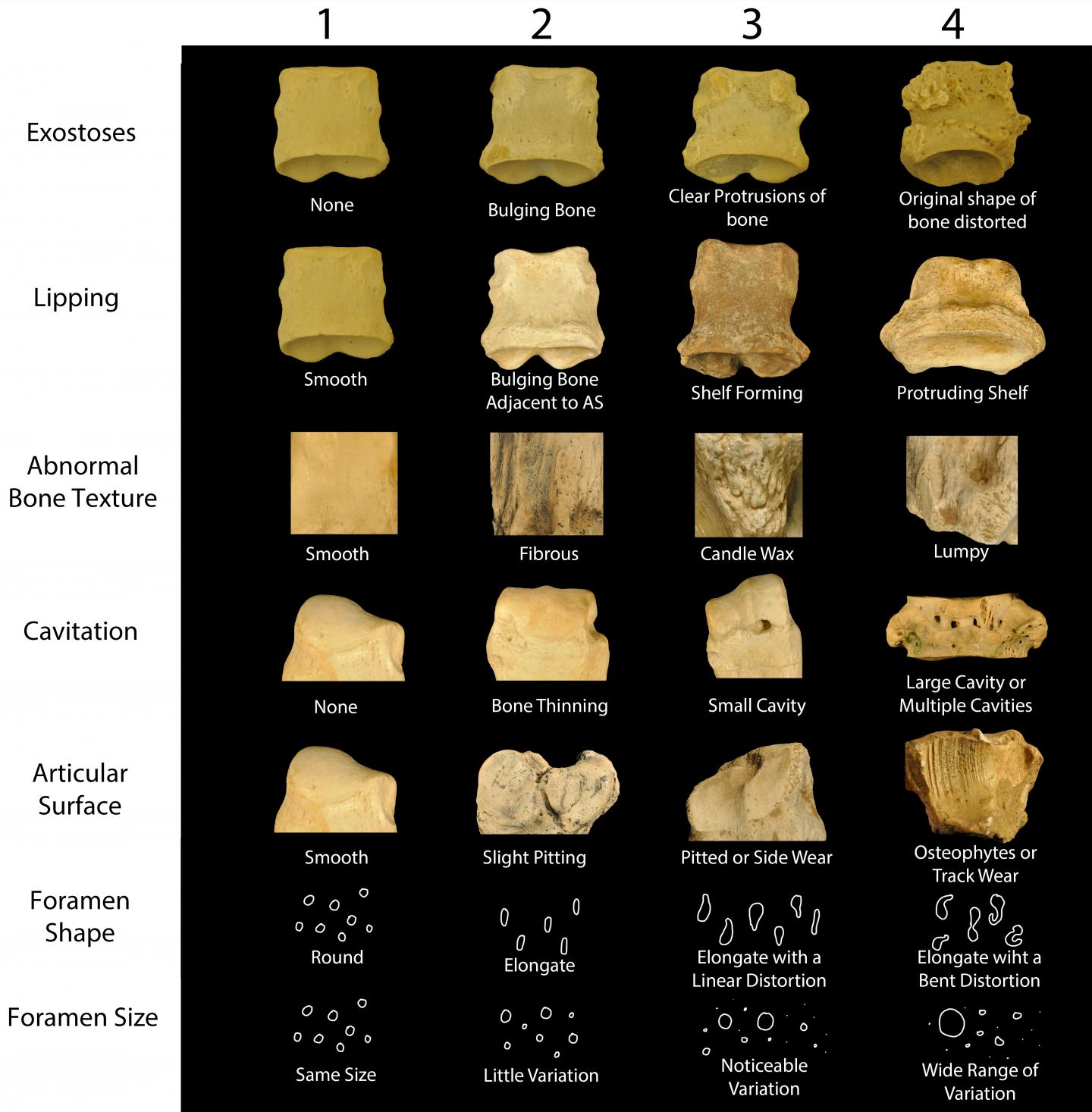 Index of Pathology (IPa) Used in This Study