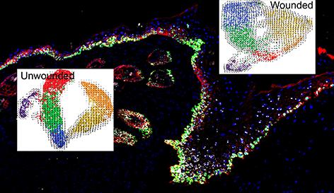 Gene Expression in a Healing Skin Wound