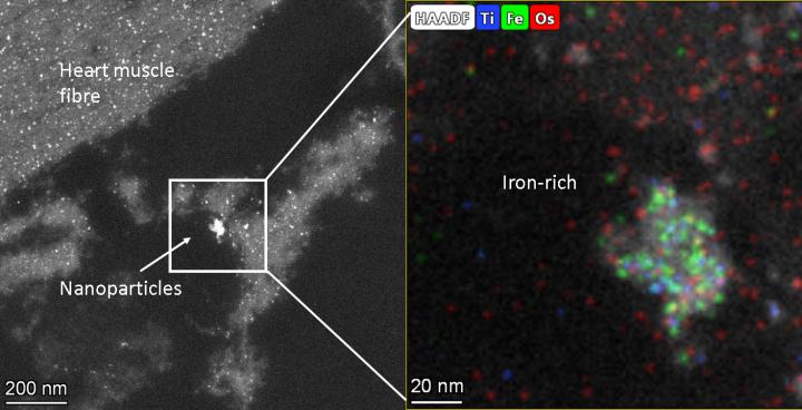 Iron-Rich Nanoparticles in Heart Cell