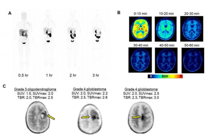 Clinical evaluation of [18F]DASA-23.