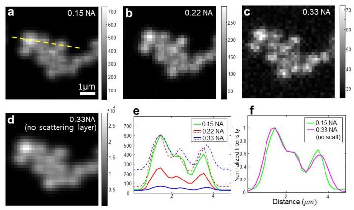 Imaging through brain tissue