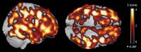 Brain Composite Image (1 of 2)
