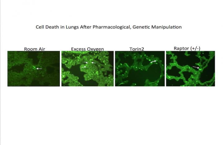 Cell Death in Lungs After Pharmacological and Genetic Interventions